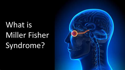 What is Miller Fisher Syndrome? - Vaccine Injury Help Center and Resources