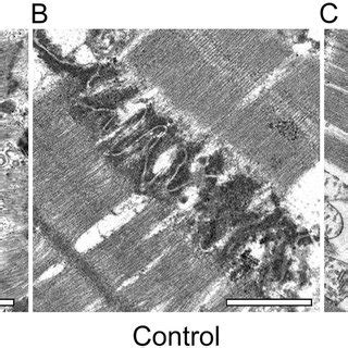 Transmission electron microscopy findings of intercalated discs in each ...