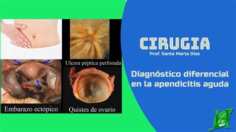 Pptx Diagnostico Diferencial De La Insuficiencia Respiratoria Hot Sex