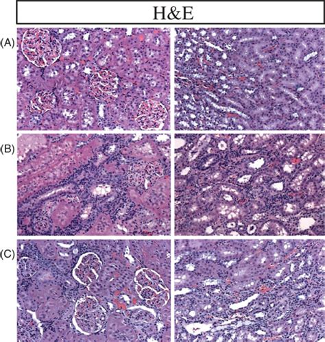 Representative Photomicrographs Of The H E Stained Renal Tissue X