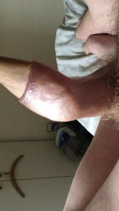 Foreskin Stretch On Saturday Wooden Spoon British Gay Amateur Porn Xhamster