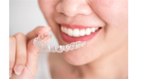 Invisalign A Complete Guide Klinika Dental Clinic