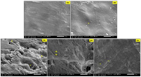 A E Higher Magnification Of Scanning Electron Photomicrographs Of