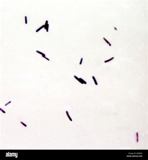 Gram positive clostridium hi-res stock photography and images - Alamy