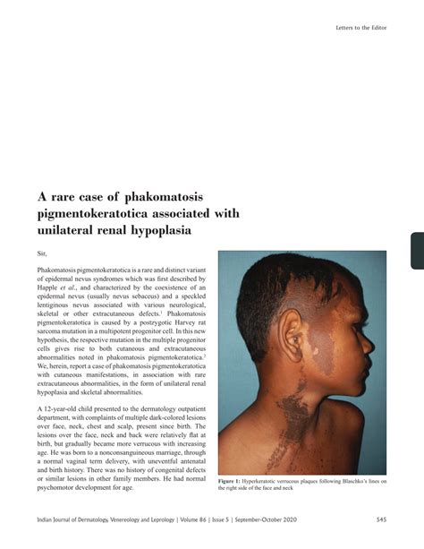 Pdf A Rare Case Of Phakomatosis Pigmentokeratotica Associated With