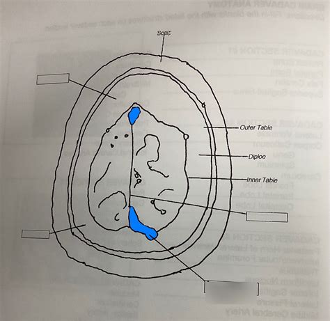 Ct Scan Diagram Slice Diagram Quizlet