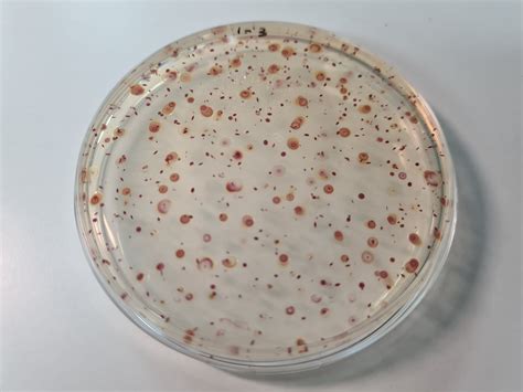 Plate Count Agar Pca Polvo Aer Bico