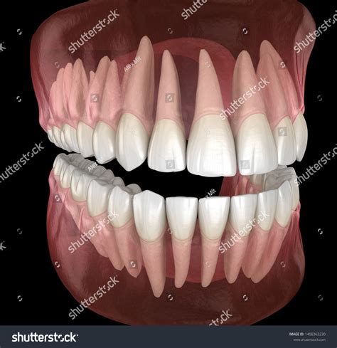 Morphology Mandibular Maxillary Human Gum Teeth Stock Illustration