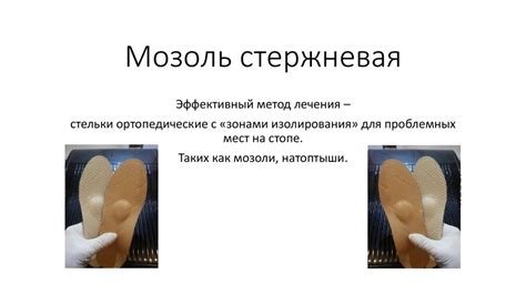 Мозоль стержневая - online presentation