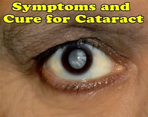 Types Of Cataracts With Symptoms And Treatment