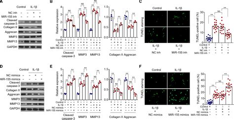 MiR155 promotes interleukin1βinduced chondrocyte apoptosis and