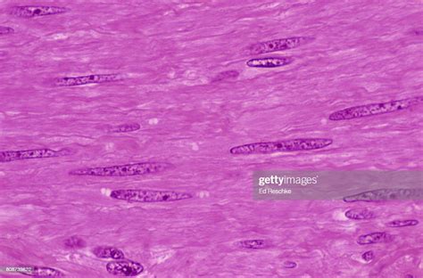 Smooth Muscle Human Uterus Foto De Stock Getty Images