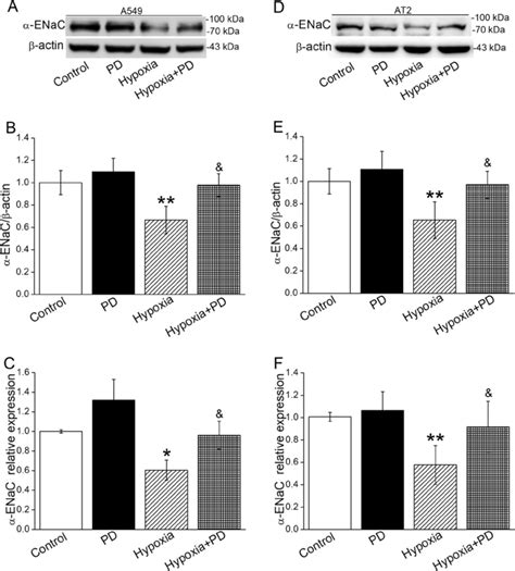 Hypoxia Induced Decrease Of Enac Was Mediated By The Activation Of