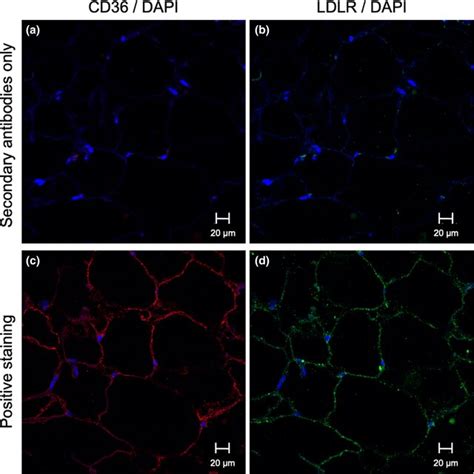 Representative Plasma Membrane Localization Of CD36 And LDLR By