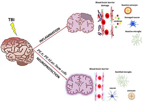 Antioxidants Free Full Text Management Of Traumatic Brain Injury