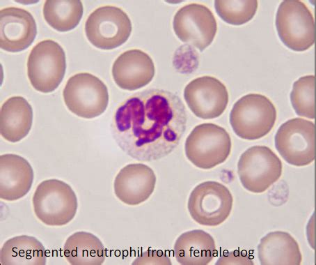 WBC Normal Morphology Flashcards Quizlet