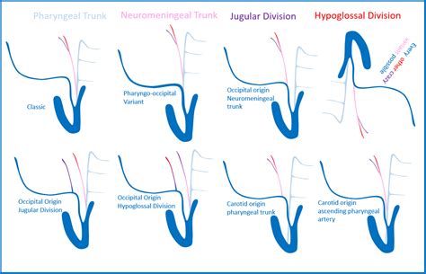 Ascending Pharyngeal Artery | neuroangio.org