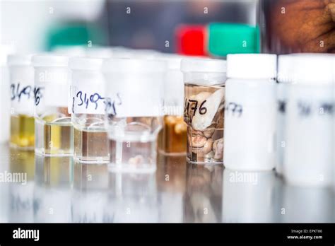 Tissue Samples In Clinical Laboratory Stock Photo Alamy