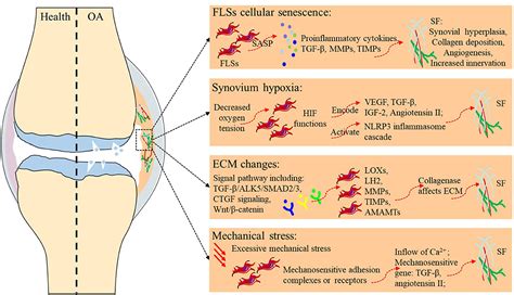 Frontiers Synovial Fibrosis Involvement In Osteoarthritis