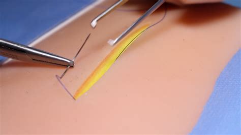 Subcuticular Suture Osce Guide Surgical Skills Geeky Medics