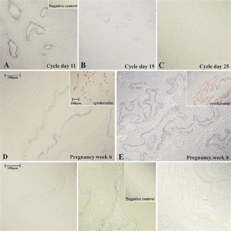 Immunohistochemical Detection Of Interleukin IL 11 In Human