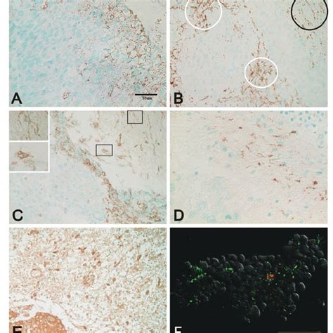Immunohistochemical staining of paraffin-embedded brain section with ... 