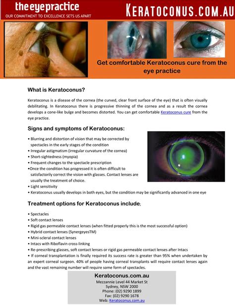 Ppt Get Comfortable Keratoconus Cure From The Eye Practice Powerpoint