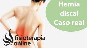 Ejercicios De Pilates Recomendado En Caso De Hernia Discal Lumbar