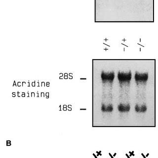 Reduced Expression Of Calretinin Mrna And Protein In Cr Mice A