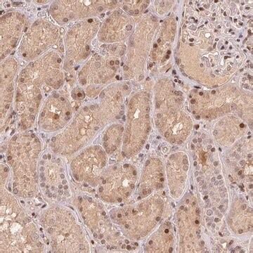 Anti MAPKAPK2 Antibody Produced In Rabbit MAP Kinase Activated