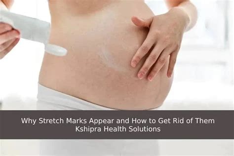 Why Stretch Marks Appear And How To Get Rid Of Them Kshipra Health Solutions