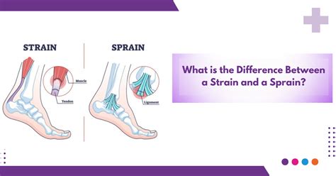 What Is The Difference Between A Strain And A Sprain