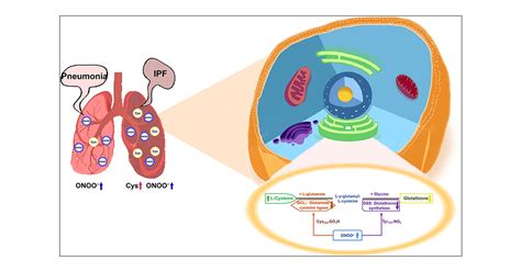 Exploring Idiopathic Pulmonary Fibrosis Biomarker By Simultaneous Two