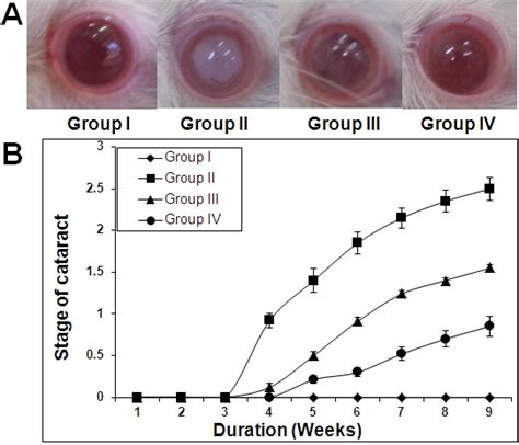 Delay of diabetic cataract in rats by ginger. A: Representative ...