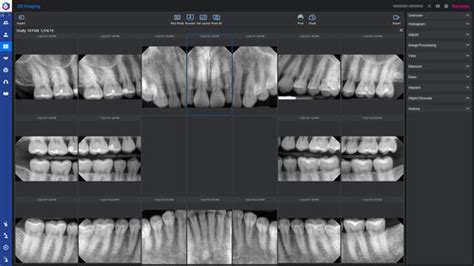 Romexis 2d Standard Planmeca