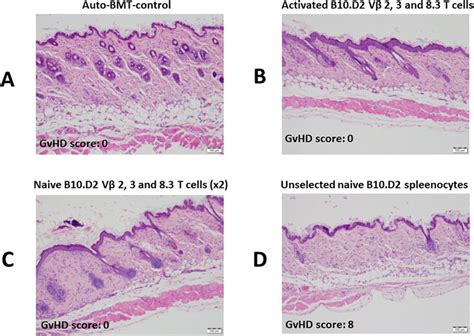 Histologic changes in skin. Comparive histology of skin tissue ...