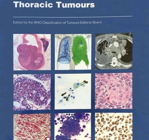 Classification Oms L Ad Nocarcinome Pulmonaire In Situ A T