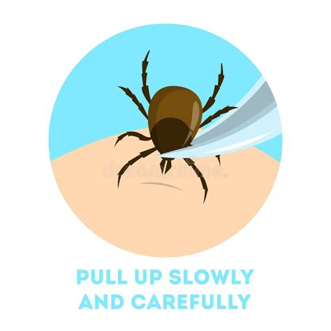 How To Remove Tick Stock Illustrations 22 How To Remove Tick Stock Illustrations Vectors