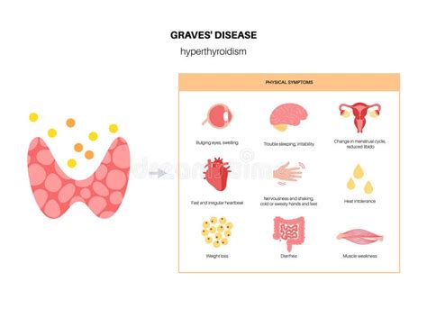 graves disease symptoms stock illustrations  graves disease