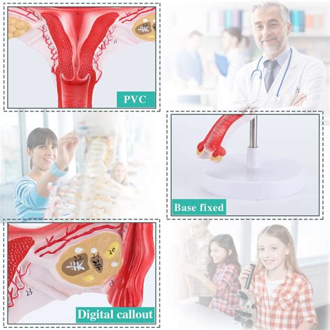 Ronten 11 Human Female Uterus Ovary Model Ubuy Bermuda