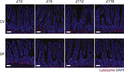 The Microbiota Coordinates Diurnal Rhythms In Innate Immunity With The