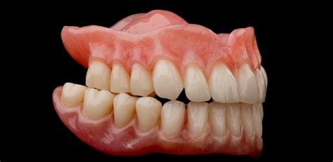 Cosmetic Dentures Smile Design By Ash