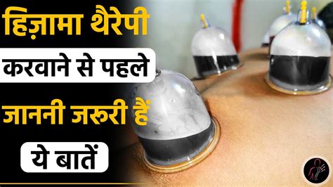 Hijamawet Cupping Therapy Benefits And Side Effectsजरूर जाने ये