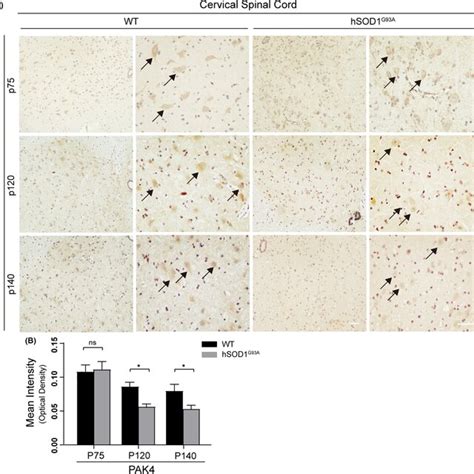 The Expression Of PAK4 Decreased In The Cervical Spinal Cords Of