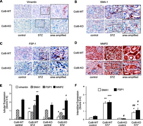 A F Protein Expression Of Mesenchymal Markers And The Number Of