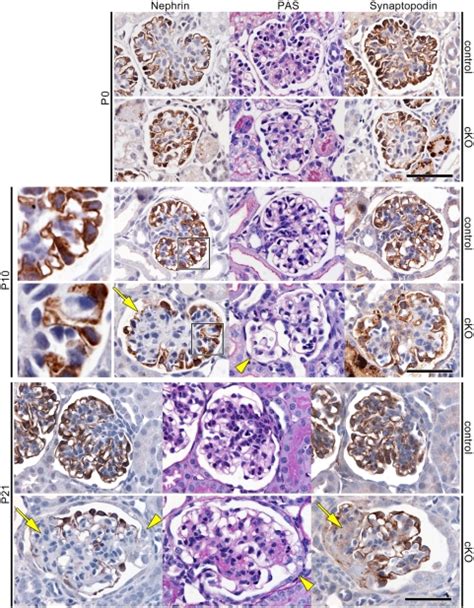 Periodic Acid Schiff Staining PAS And Immunohistochemistry For