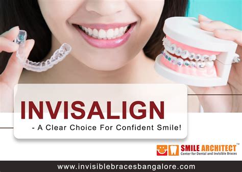 Every Smile Is Unique Show Off Your Smile With Invisalign Our