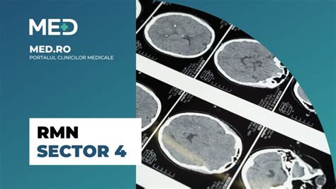 RMN Sector 4 Top 5 Clinici Verificate Med Ro