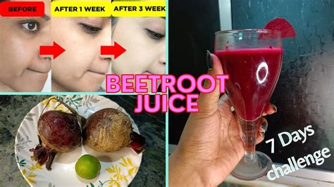 Beetroot Juice Recipe For Glowing Skin Immunity