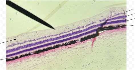 layers of retina Diagram | Quizlet